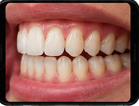 Head turned to show right side teeth